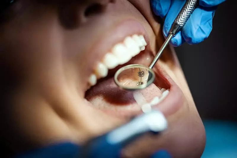 A dentist provides a strong brand promise by examining a woman's mouth.